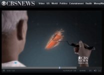 3D holograms help Israeli heart surgeons - CBS News.jpg
