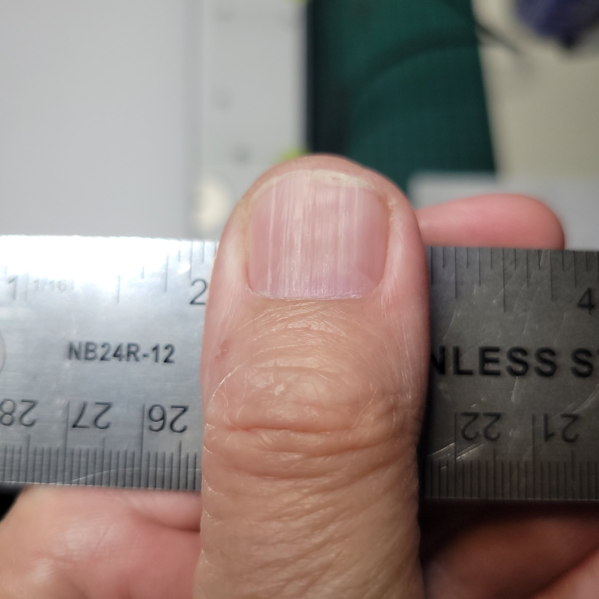 1000002790.jpg