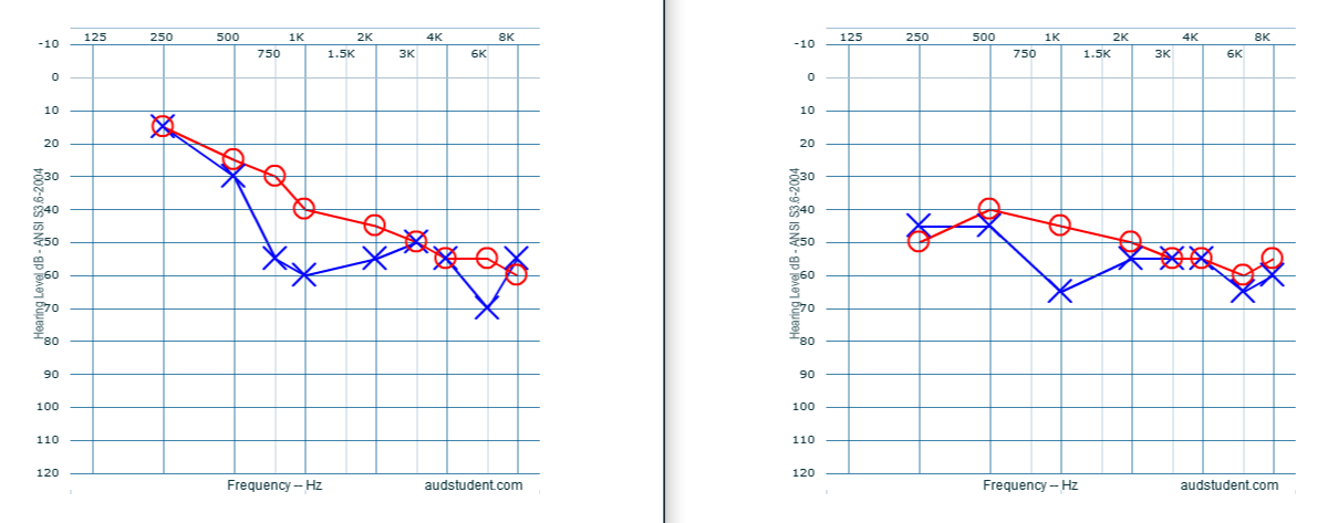 audiogram.png