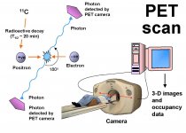 PET scan.jpg