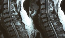 1_MRI_C6.jpg
