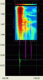 CSD_tube_Mige0.gif