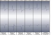 two channel scratch(2).JPG