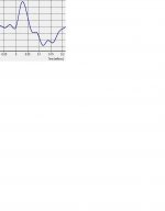 Impulse response.JPG