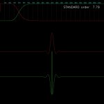 STANDARD xo freq 4000Hz order  7.79.JPG