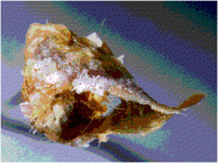 earwax.gif