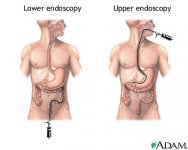endoscopy-digestion3.jpg