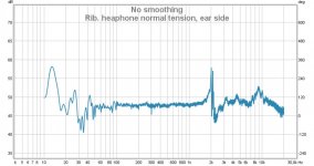 headphone_norm_tension_ear_side.jpg