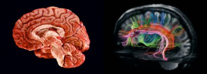 Brain Cells - nerve connections.jpg