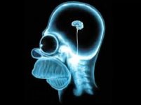 xray.jpg