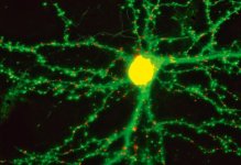 Brain Cell - Tom's.jpg