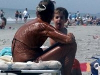 sunburn.jpg