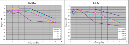 My audiogram data.PNG