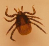 Ixodes_ricinusklein.jpg