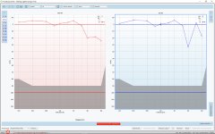 Audiogram 20171128.jpg