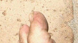 toes.jpg