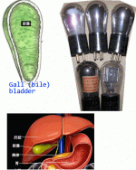 Bile-bladder-42.gif