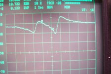 Shunt4.jpg