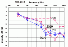 Audiogram-Me-Anony.gif