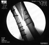 xray1.jpg