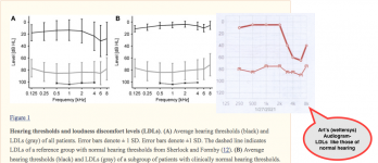 Hearing Thresholds and loudness discomfort levels (LDLs).png
