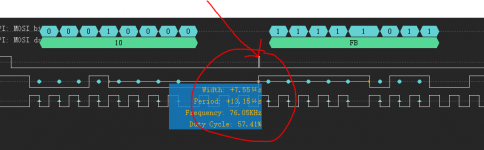 SPI（NG）ZOOM.PNG