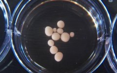 Brain Organoids.jpg