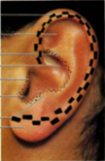 enabulled ear.png