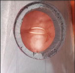 mid_inner_chamfer.PNG