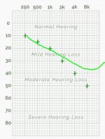 hearing test.JPG